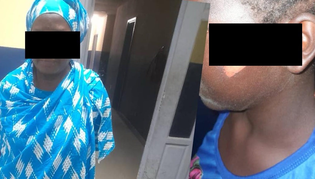 Une fillette de 12 ans brûlée par sa tante pour n’avoir pas rapporté assez d’argent
